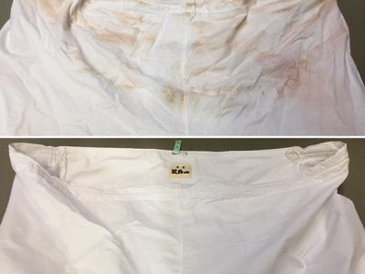 シミ抜き事例byインスタグラム