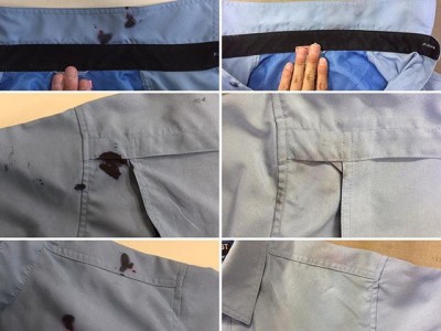 シミ抜き事例byインスタグラム