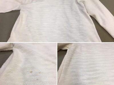 シミ抜き事例byインスタグラム