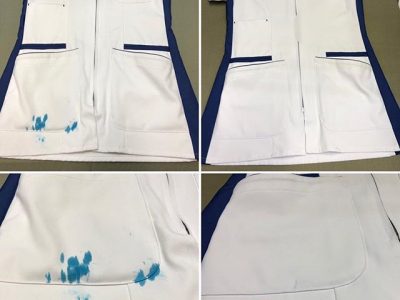 シミ抜き事例byインスタグラム【白衣についた水性マーカー（インク）のシミ抜き】